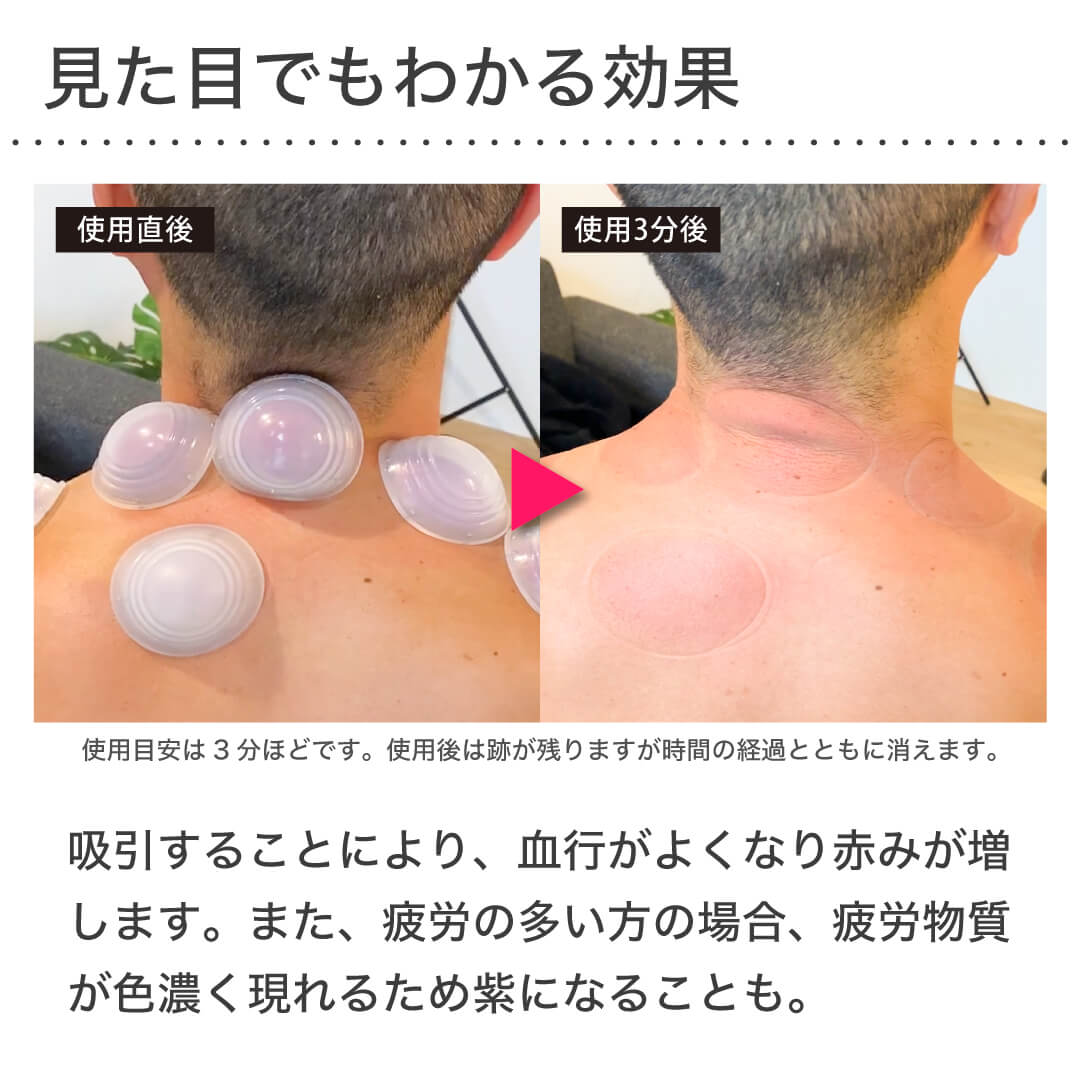 楽天市場】Activital 解脱玉ゲルマ / リカバリーボール 吸い玉セルフ