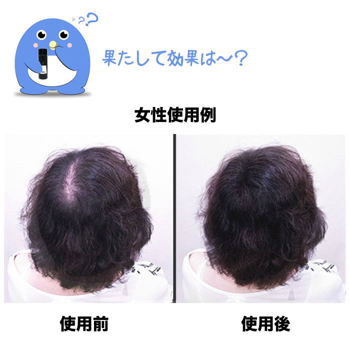 楽天市場】増毛パウダー シークレットプラス ブラック 50g 3点セット