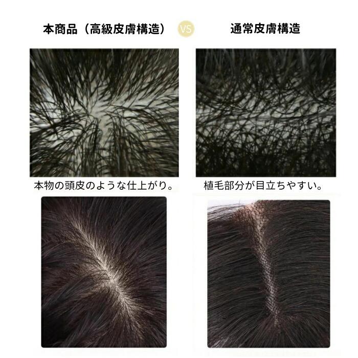 楽天市場】人毛100% 部分ウィッグ 頭頂部 トップカバー 前髪ウィッグ