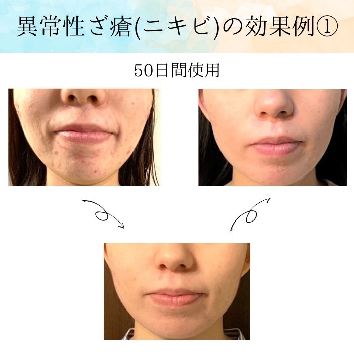 楽天市場】美ST7月号掲載【正規販売代理店】Purepeatpack ピュアピート