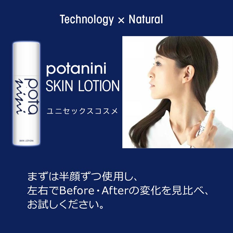 楽天市場】LINEクーポンあり！ポタニーニ スキンローション【 送料無料