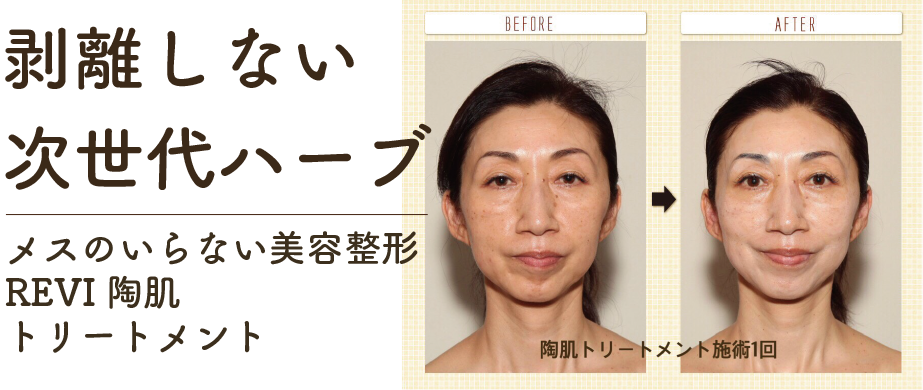 REVI（ルヴィ）陶肌トリートメント│京都 宇治・伏見のエステサロン