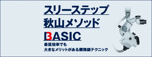 スリーステップ秋山メソッド BASIC 最低倍率でも大きなメリットがある