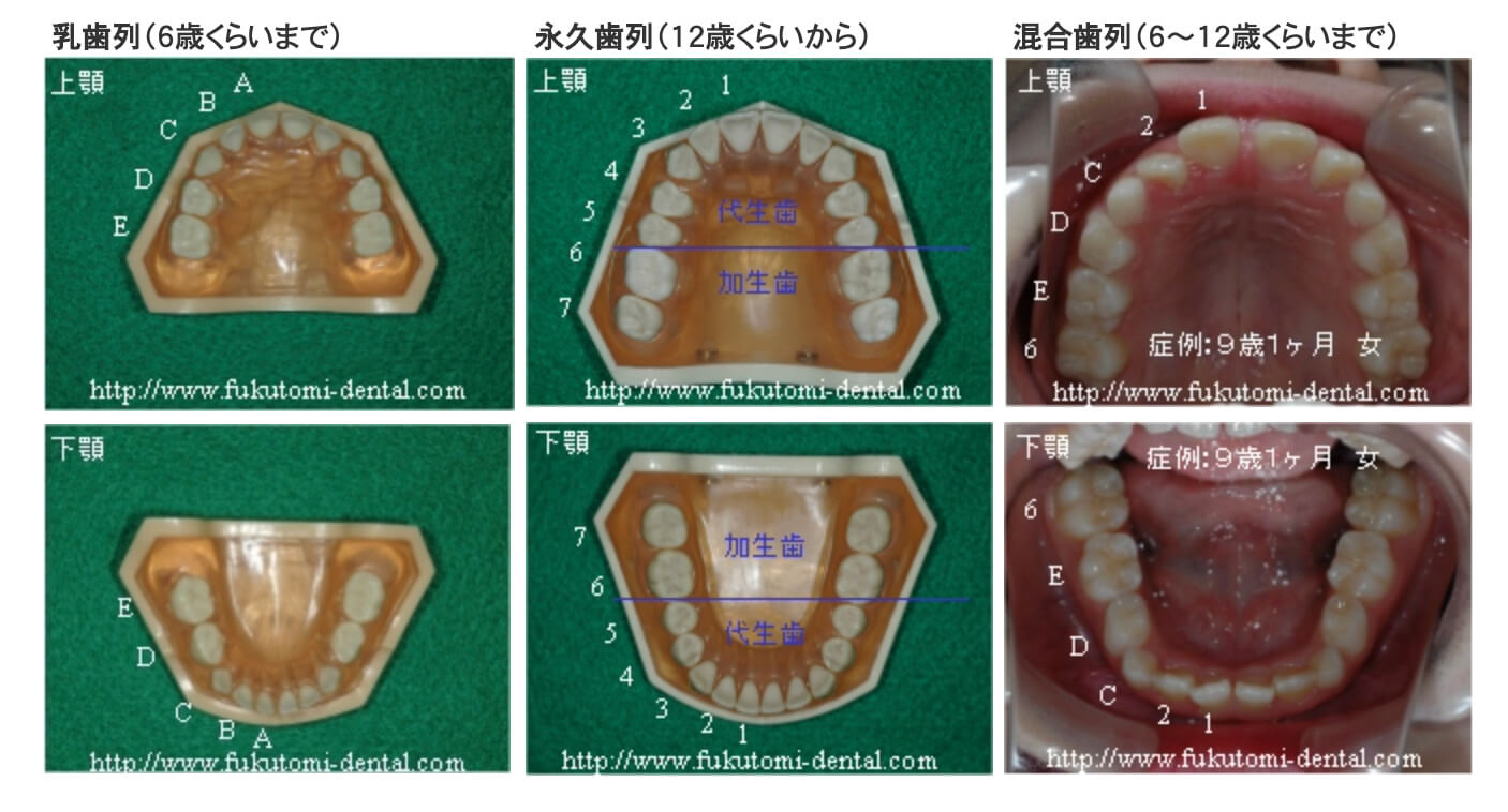 2個 歯列模型 実物大 開閉式 乳歯期 永久歯萌出前 永久歯 交換