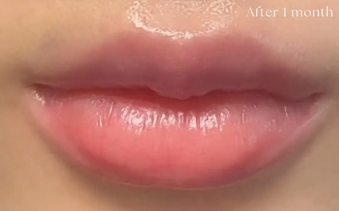 Roma Pink-ローマピンク- | フェイシャル【エステサロンKAREN（カレン）】