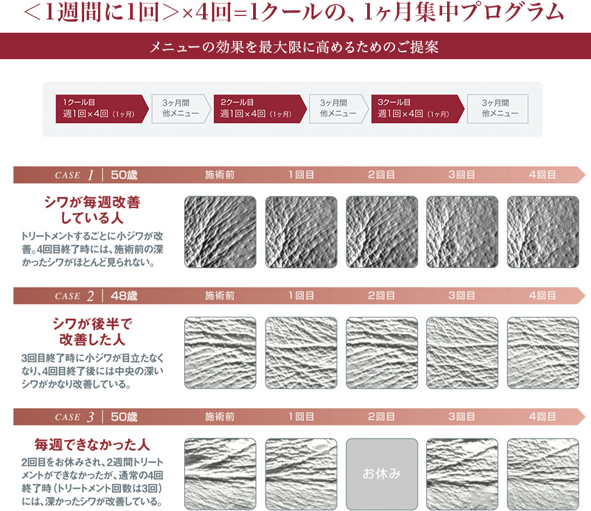 ダイレクト パフォーマンス X｜プロユース製品＆メニュー｜ラフォーレ