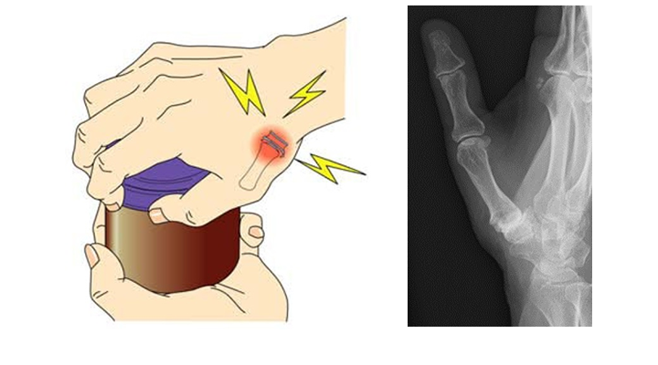 整形外科 手・肘関節クリニック | 星ヶ丘医療センター | 地域医療機能