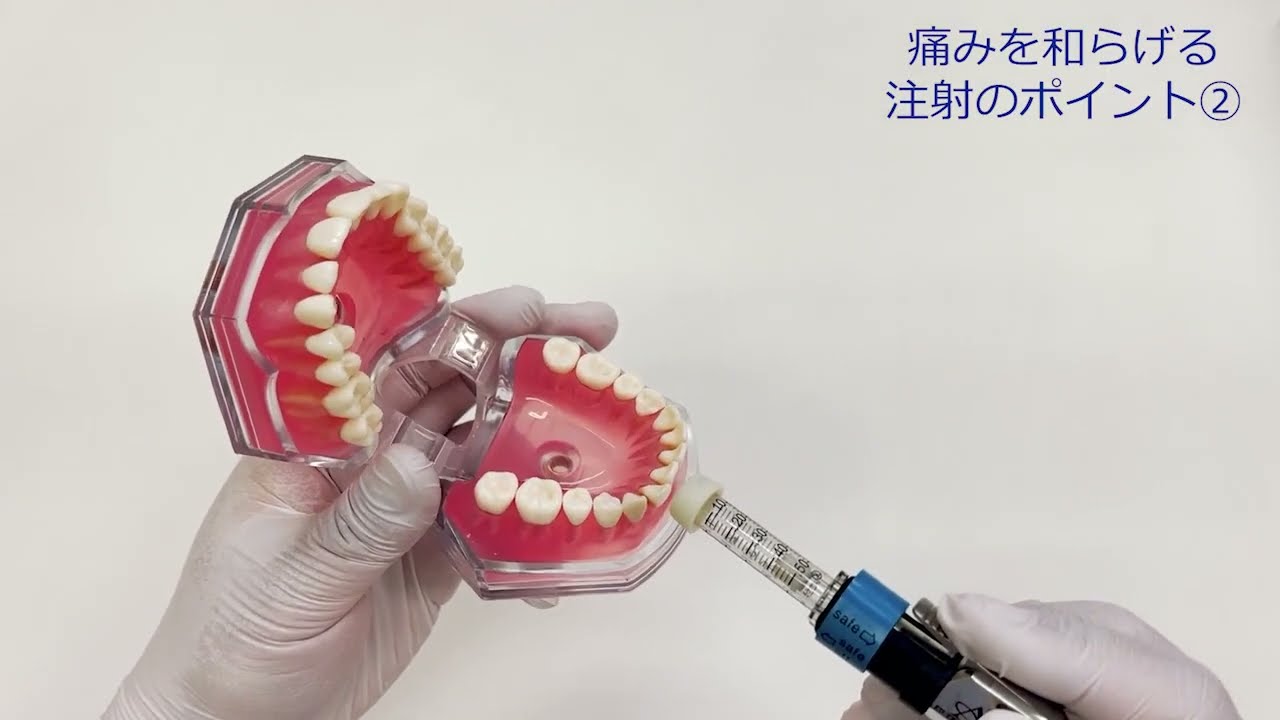針なし注射器【Injex50公式】（歯科向け）使用上の注意・ポイント解説
