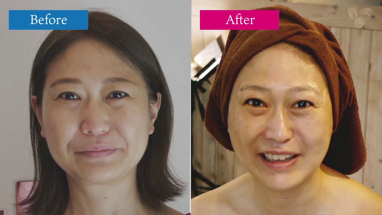 REVIの真実】5分でわかる！ハーブピーリング陶肌トリートメント【B/A有