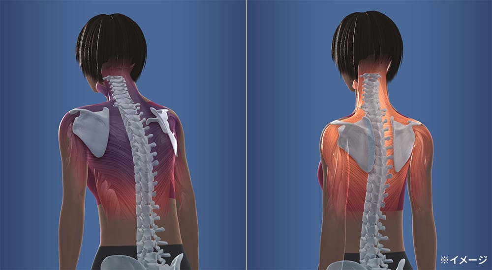 スリムビューティパッド 通販 - ディノス