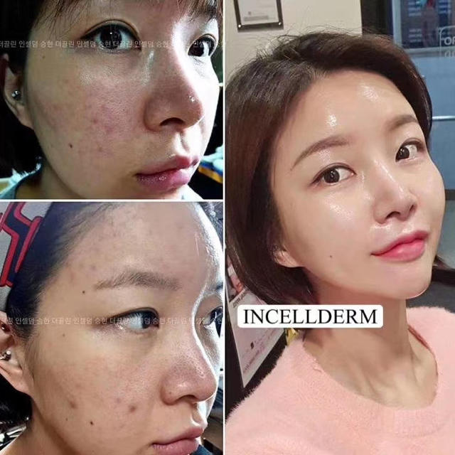 Incellderm インセルダム 3点セット 新品未開封 お買い得の通販 by と