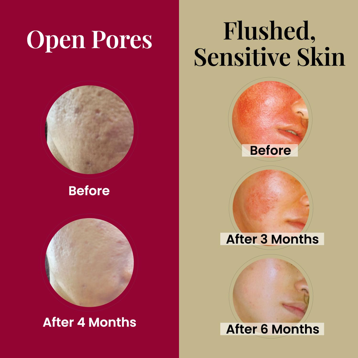 Amazon.com: LABO Nutrition Le Revital Concentrated Nano Placenta