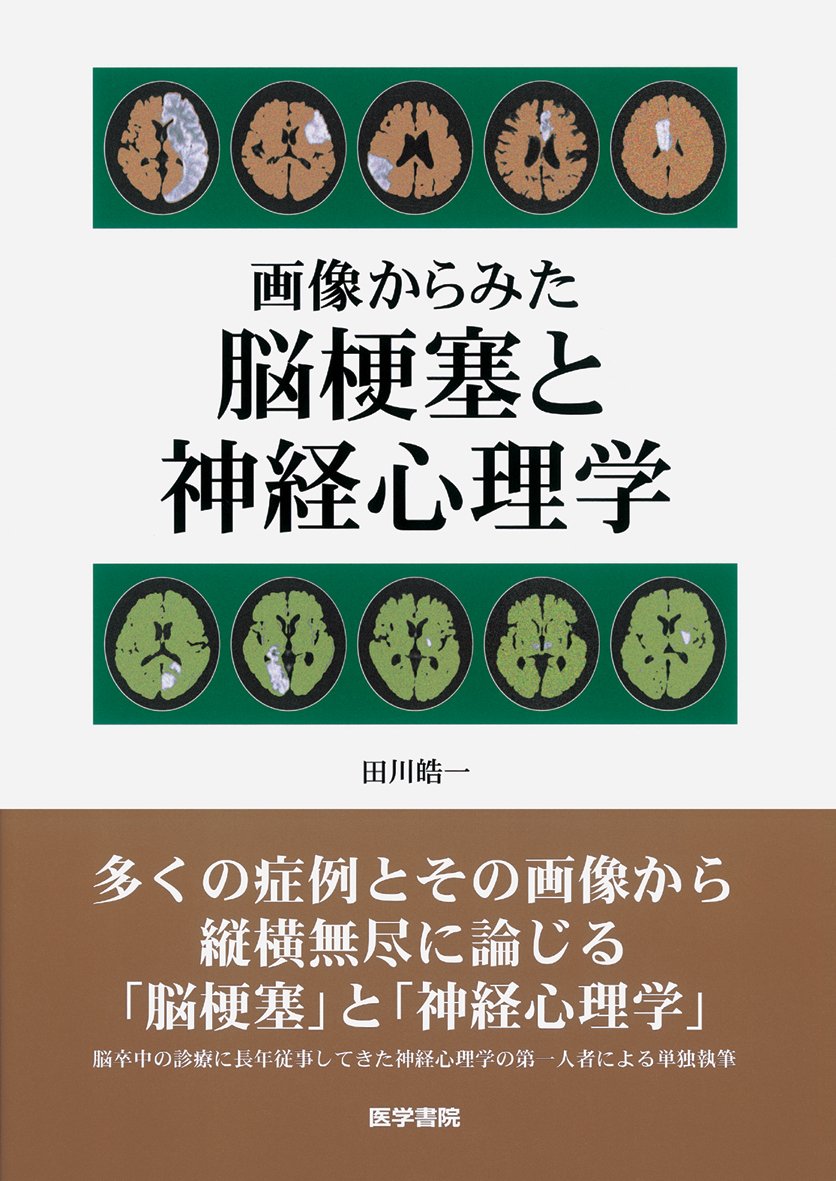 画像からみた 脳梗塞と神経心理学 | 田川 皓一 |本 | 通販 | Amazon