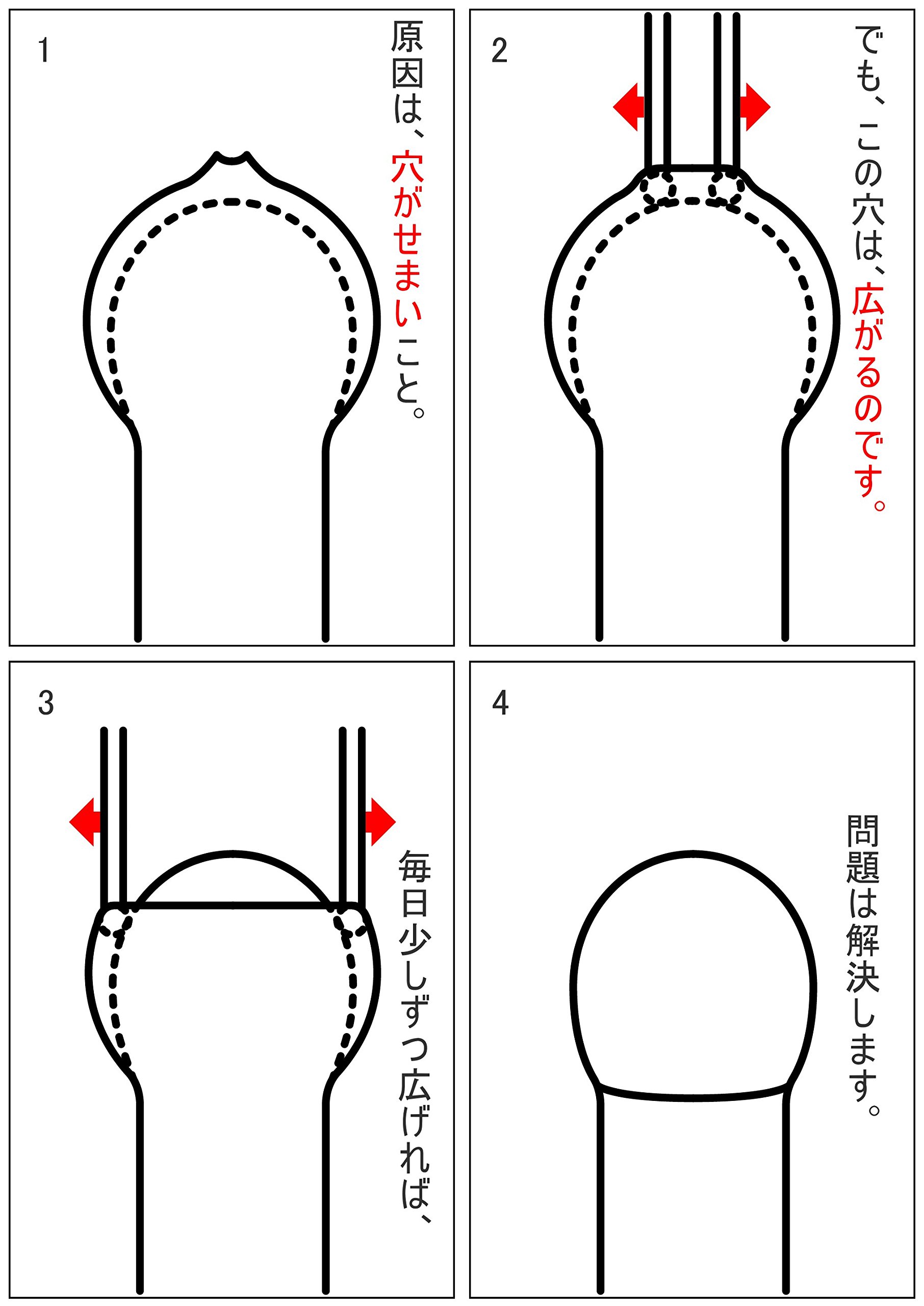 Amazon.co.jp: キトー君DX 3本セット : ドラッグストア