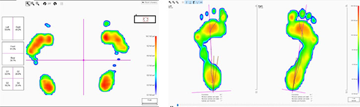 足底圧計測システム footscan®:足形計測ならJust My Shoes【株式会社