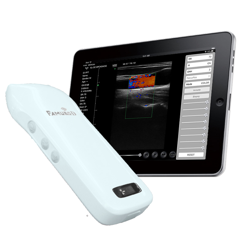 超音波画像計測装置Famubo-D | 誠鋼社 SEIKOSHA 美容・エステサロン