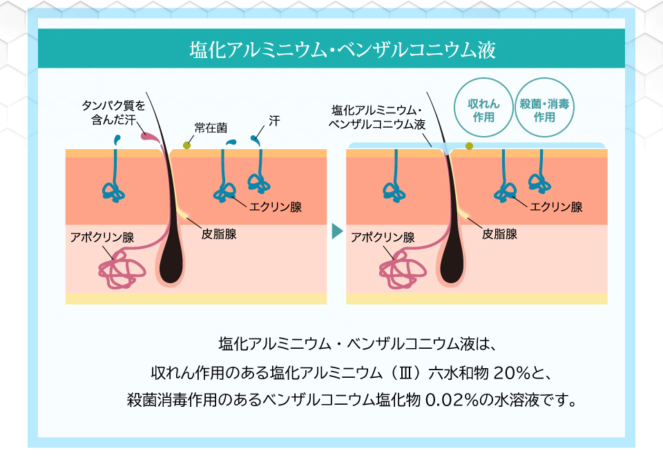 えびす調剤薬局 大容量 塩化アルミニウム20%配合 塩化アルミニウム