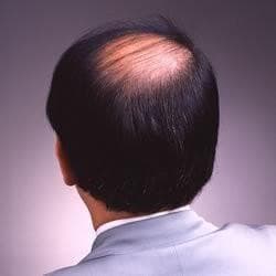 【正規品】ワンタッチグローEX+4 200g【5本セット】☆携帯用おまけ付き