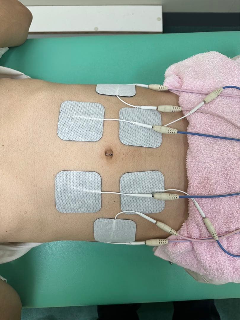 EMS粘着パッド40枚　整骨院楽トレ　バイトレJOYトレEMSパット 電極パッド