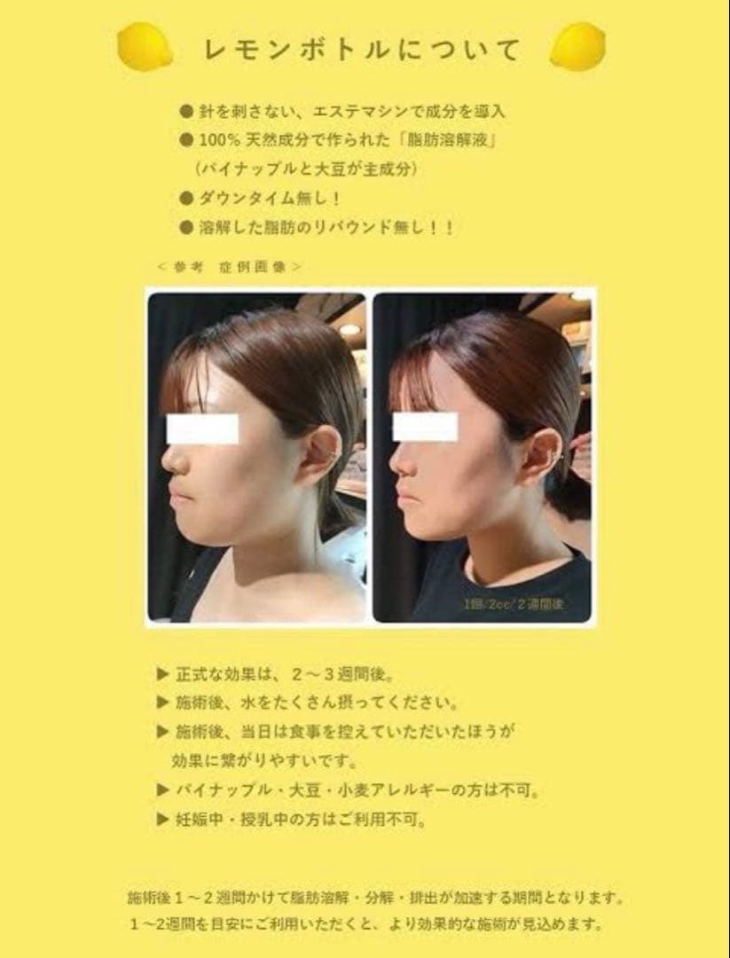 e☆プロフィール必読下さい☆ 　レモンボトル3本