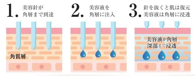 新品 IPS DERMA INJECTORダーマインジェクター2.5ml 箱入り