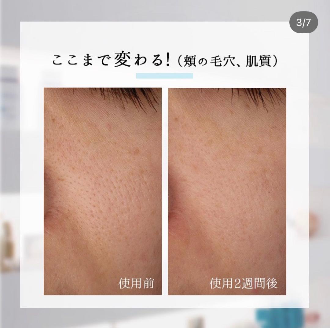 【未使用に近い】レカルカ FVC5 バブルパック（泡化粧水）