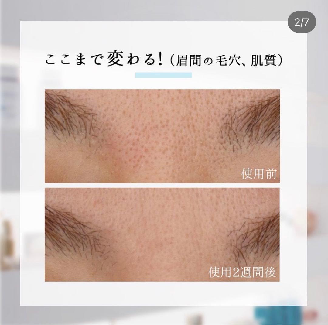 【未使用に近い】レカルカ FVC5 バブルパック（泡化粧水）